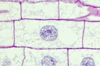 Racine de Blé - Cellule végétale en cours de division (mitose) : interphase x150